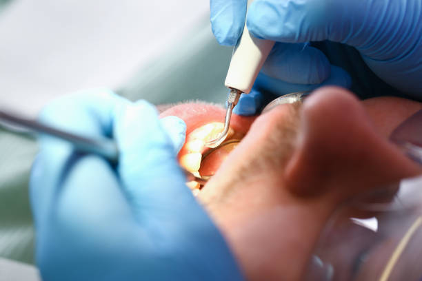 Best Cracked Tooth Emergency Dentist  in Pottstown, PA